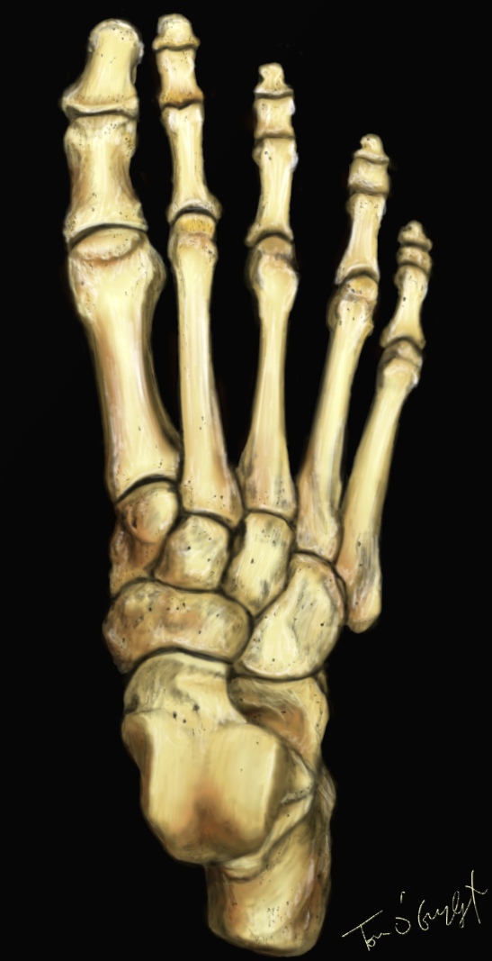 squelette pied fracture metatarsien