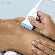 échographie musculo tendineuse au genou avec sonde linéaire haute fréquence